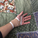 The mass of gauze and tape makes it look worse than it is.